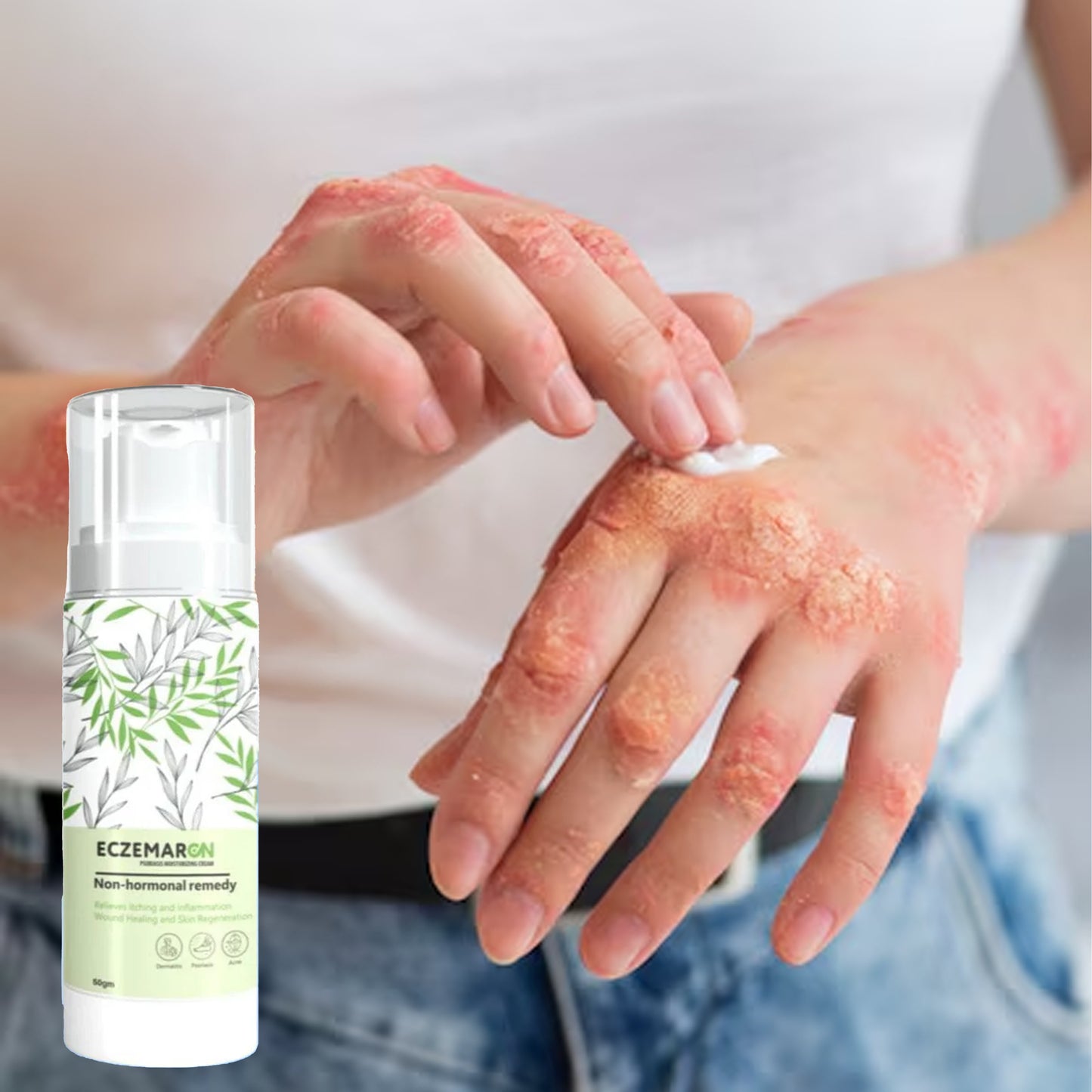 Eczemaron Anti Fungal Cream