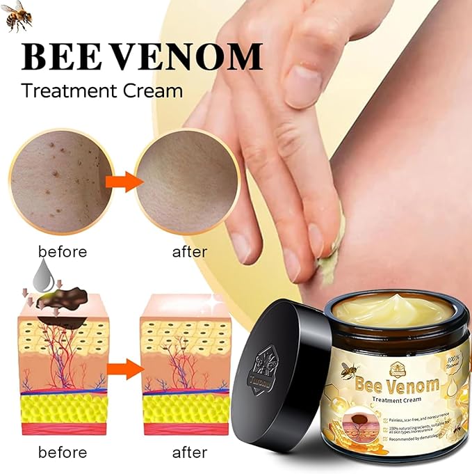 Bee Venom Pain-Relief Bone Healing Cream (BUY 1 GET 1 FREE)