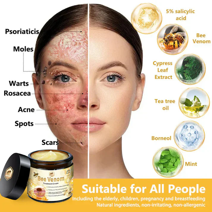 Bee Venom Pain-Relief Bone Healing Cream (BUY 1 GET 1 FREE)