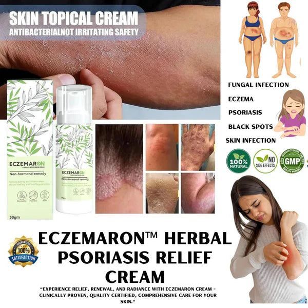 Eczemaron Anti Fungal Cream