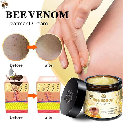 Bee Venom Pain-Relief Bone Healing Cream (BUY 1 GET 1 FREE)