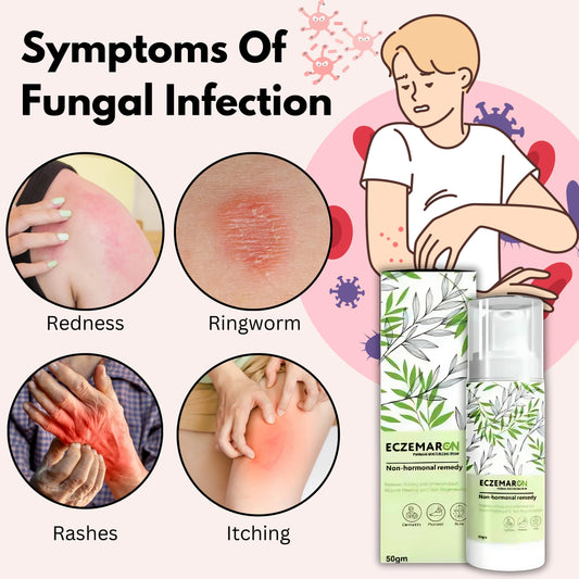 Eczemaron Anti Fungal Cream