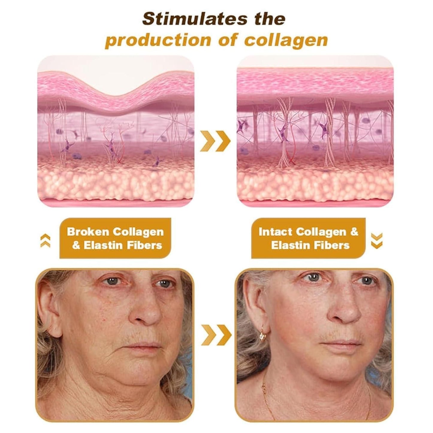 BeeTox™ - Bee Venom Wrinkle Repair Cream 🐝✨