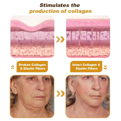 BeeTox™ - Bee Venom Wrinkle Repair Cream 🐝✨